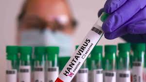 Nuevas herramientas contra el hantavirus avanzan pese a falta de financiamiento